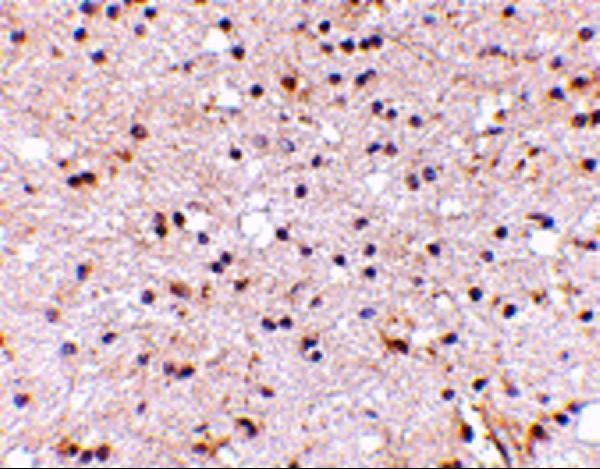 a09667 nptx2 primary antibodies ihc testing 5