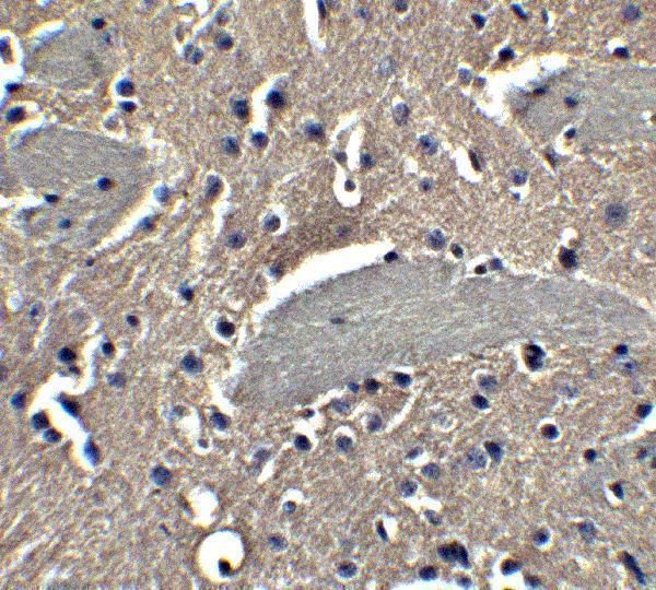 a09667 nptx2 primary antibodies ihc testing 7