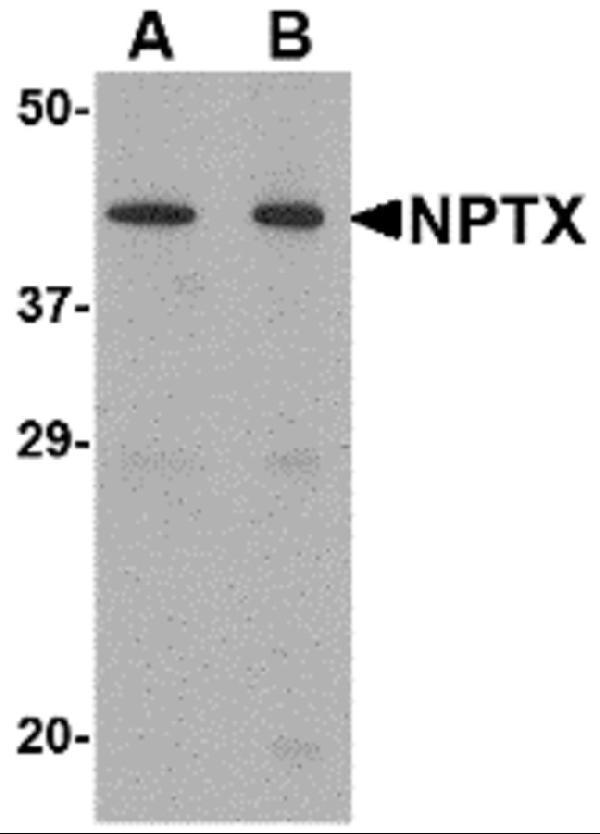a09667 nptx2 primary antibodies wb testing 1