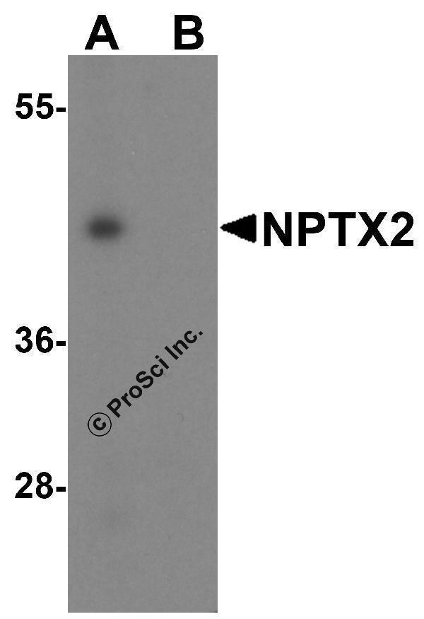 a09667 nptx2 primary antibodies wb testing 3