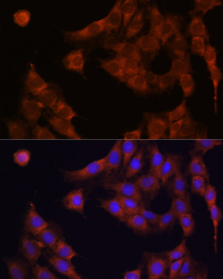 Immunofluorescence analysis of C6 cells using GANAB antibody  at dilution of 1:100