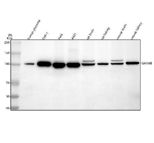 Western blot analysis of GANAB using anti-GANAB antibody (A09668-2)