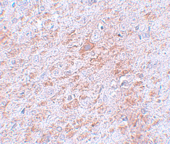 Immunohistochemistry of DLCK2 in rat brain tissue with DLCK2 antibody at 5 μg/mL