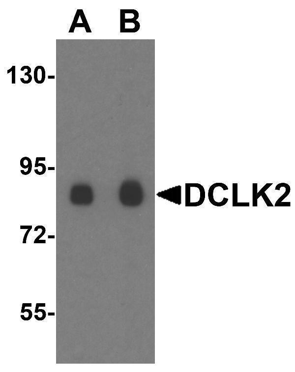 Western blot analysis of DCLK2 in rat brain tissue lysate with DCLK2 antibody at (A) 1 and (B) 2 μg/mL