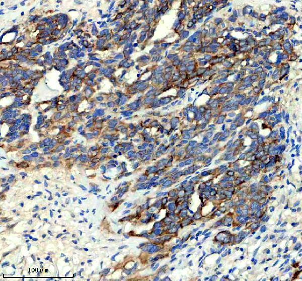 IHC analysis of KIF2B using anti-KIF2B antibody (A09674-1)