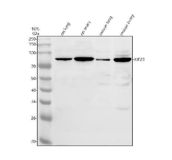 Western blot analysis of KIF2B using anti-KIF2B antibody (A09674-1)