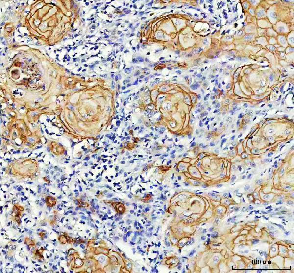  IHC analysis of LY6D using anti-LY6D antibody (A09680)