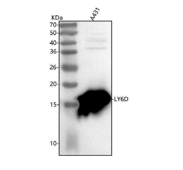  Western blot analysis of LY6D using anti-LY6D antibody (A09680)