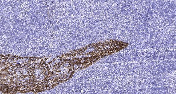 a09681 1 baiap2l2 primary antibodies ihc testing 1