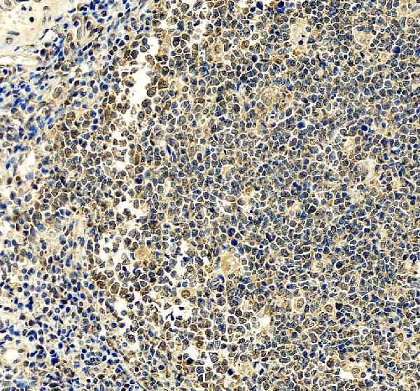 a09683 1 ubxn1 primary antibodies ihc testing 1