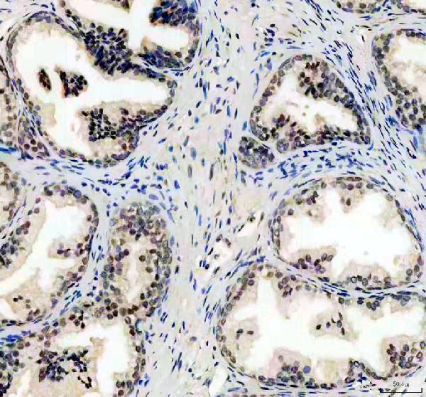 a09683 1 ubxn1 primary antibodies ihc testing 1_1