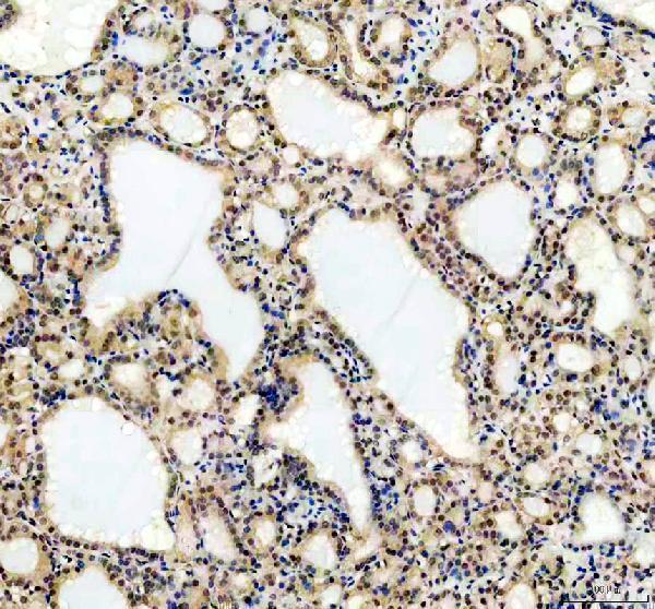 a09683 1 ubxn1 primary antibodies ihc testing 2