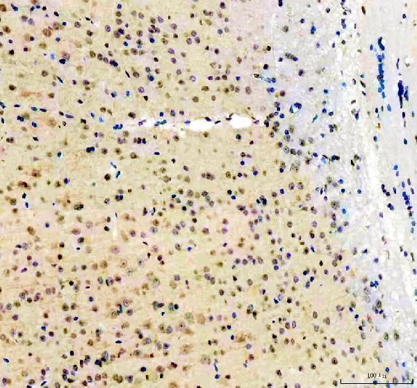 a09683 1 ubxn1 primary antibodies ihc testing 3