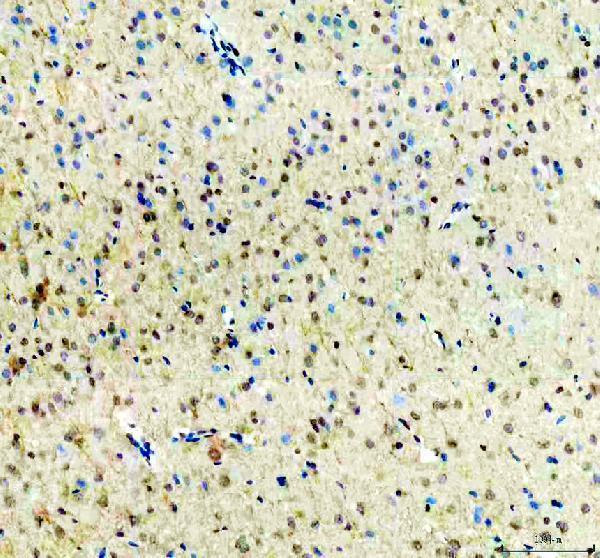 a09683 1 ubxn1 primary antibodies ihc testing 4