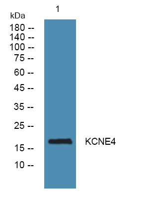 a09684 kcne4 primary antibodies wb testing 1