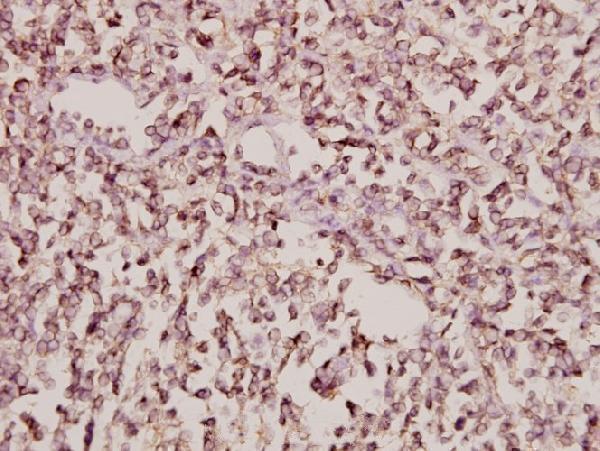 a09689 1 arfip1 primary antiboties ihc testing 2