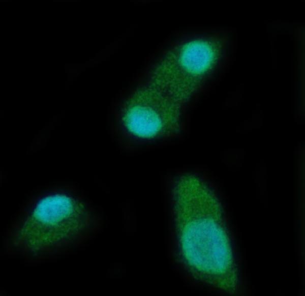 a09692 1 ythdc2 primary antibodies if testing 2