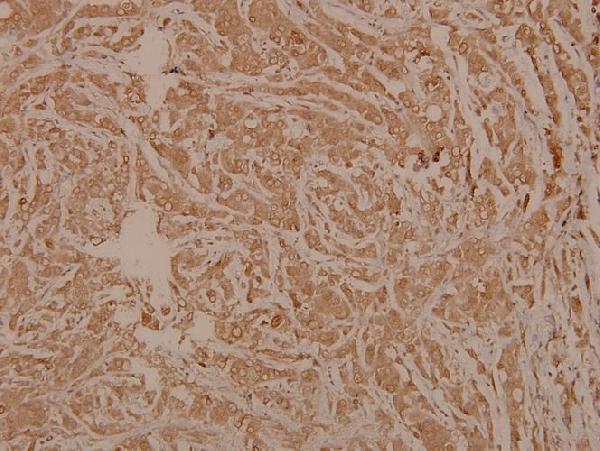 a09694 2 prim1 primary antiboties ihc testing 2
