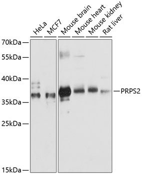 Western blot analysis of extracts of various cell lines, using PRPS2 antibody  at 1:3000 dilution