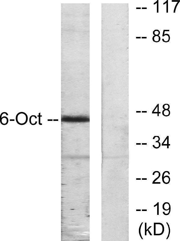 Western blot analysis of lysates from A549 cells, using OCT6 Antibody