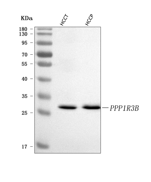  Western blot analysis of PPP1R3B using anti-PPP1R3B antibody (A09697)