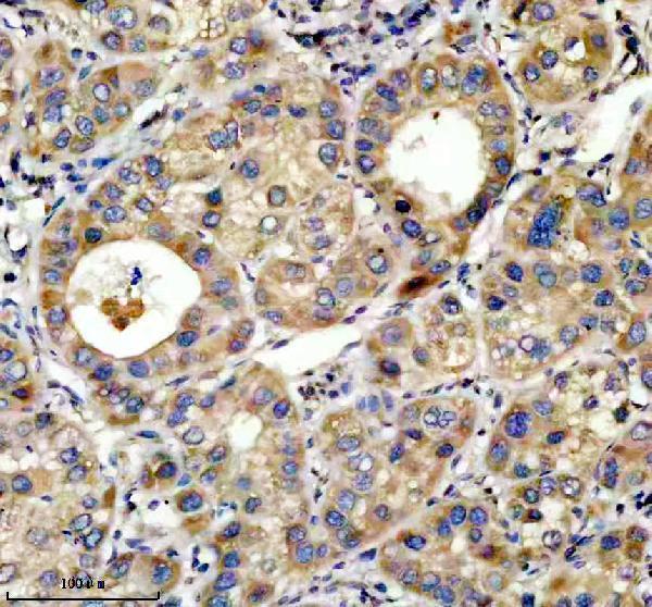 a09702 2 top1mt primary antibodies ihc testing 1