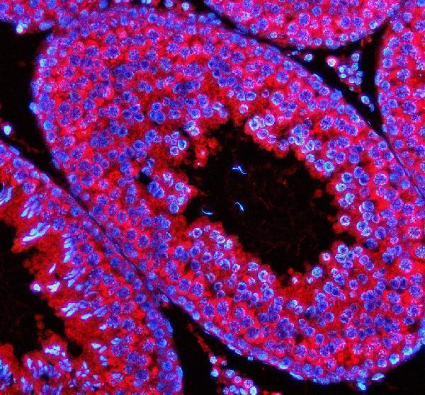 a09705 stx5 primary antibodies if testing 2