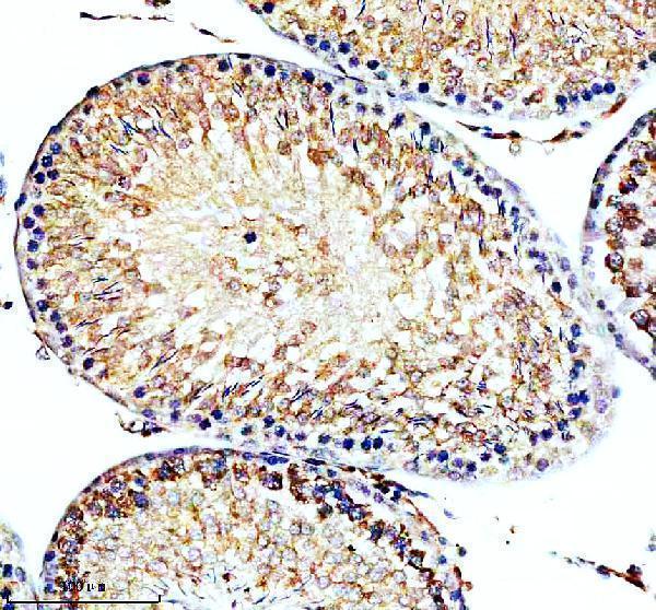 IHC analysis of STX5 using anti-STX5 antibody (A09705)