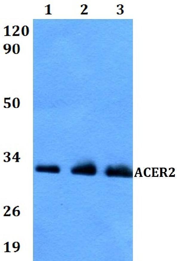Western blot (WB) analysis of ACER2 polyclonal antibody at 1:500 dilution
Lane1:A549 whole cell lysate
Lane2:MCF-7 whole cell lysate 
Lane3:PC12 whole cell lysate 