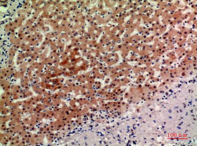 a09706 acer2 primary antibodies ihc testing 1
