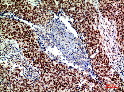 a09706 acer2 primary antibodies ihc testing 3