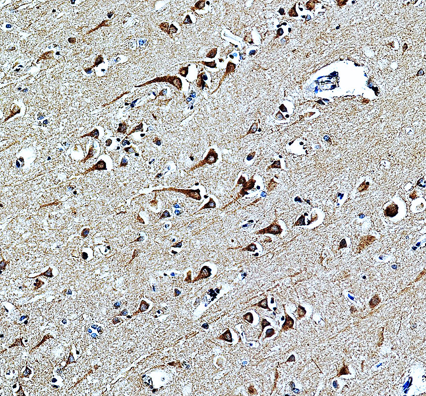 a09708 3 mrrf primary antibodies ihc testing 2
