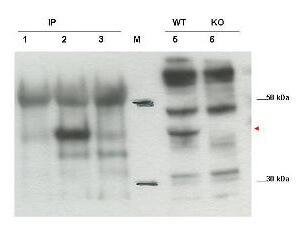 Western blot using Boster's affinity purified anti-Cybr antibody shows detection of endogenous Cybr from mouse splenocytes using anti-Cybr antibody to immunoprecipitate and western blot (lanes 1-3)