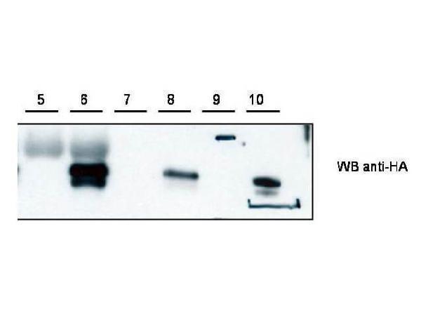 Western blot using Boster's anti-Cybr antibody shows detection of recombinant Cybr using anti-HA tag antibody after immunoprecipitation using anti-Cybr