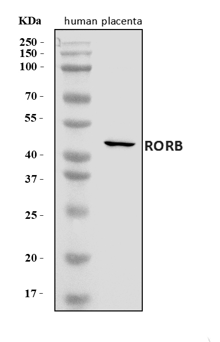 a09711 2 rorb primary antibodies wb testing 1