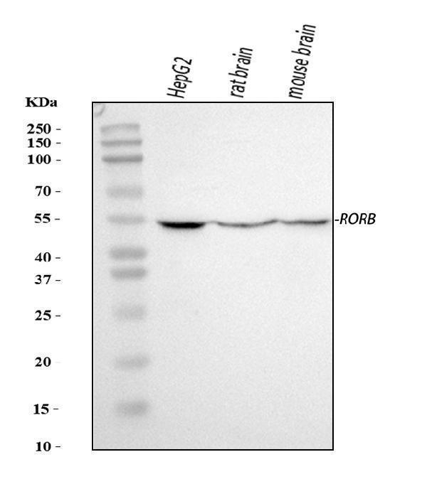 a09711 3 rorb primary antibodies wb testing 1