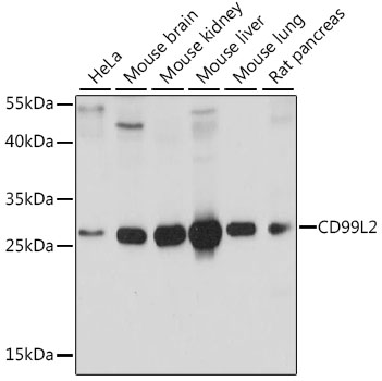 Western blot analysis of extracts of various cell lines, using CD99L2 antibody  at 1:1000 dilution