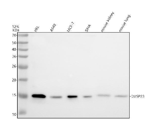 Western blot analysis of DUSP23 using anti-DUSP23 antibody (A09732)