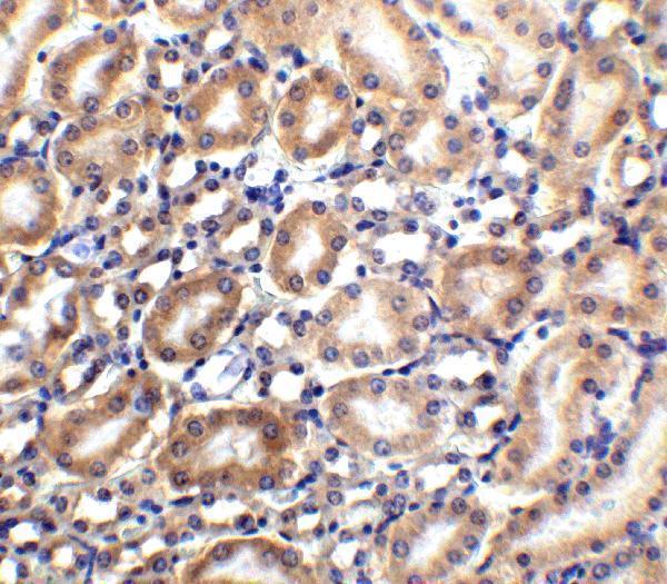 a09733 slc22a17 primary antibodies ihc testing 4