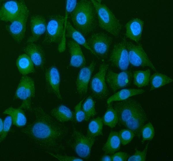 a09735 atp5g1_2_3 primary antibodies if testing 12