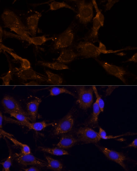 a09736 rpl27 primary antiboties if testing 2