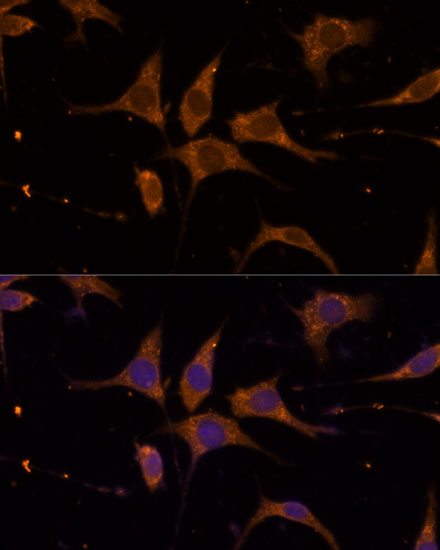 a09736 rpl27 primary antiboties if testing 3