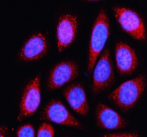 a09741 1 kntc1 primary antibodies if testing 1