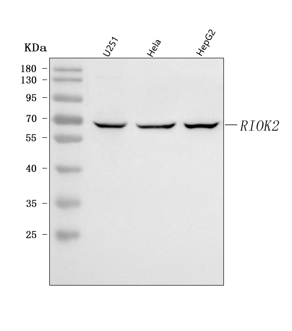  Western blot analysis of RIOK2 using anti-RIOK2 antibody (A09743-1)