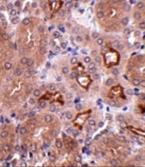 Immunohistochemistry of OTUD5 in mouse kidney tissue with OTUD5 antibody at 2
