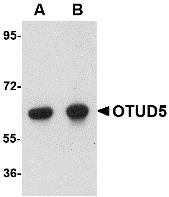 Western blot analysis of OTUD5 in human kidney lysate with OTUD5 antibody at (A) 1 and (B) 2 μg/mL
