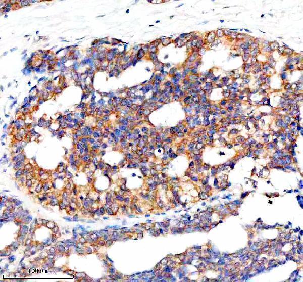  IHC analysis of B7H6/NCR3LG1 using anti-B7H6/NCR3LG1 antibody (A09747-1)