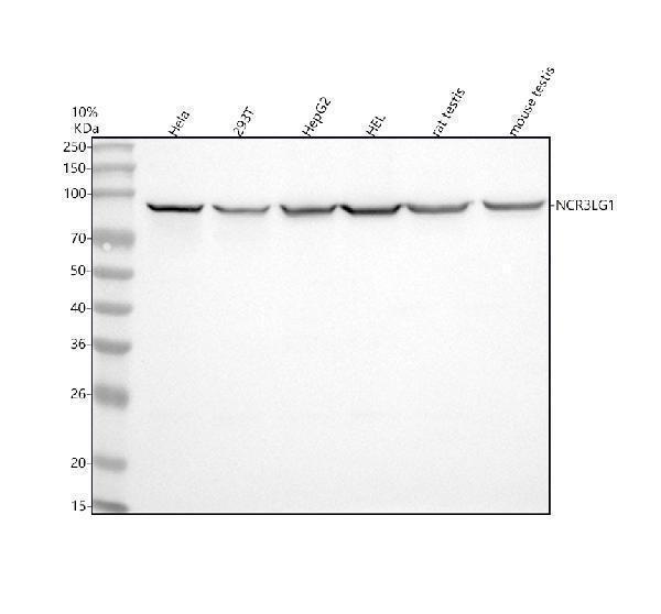  Western blot analysis of B7H6/NCR3LG1 using anti-B7H6/NCR3LG1 antibody (A09747-1)