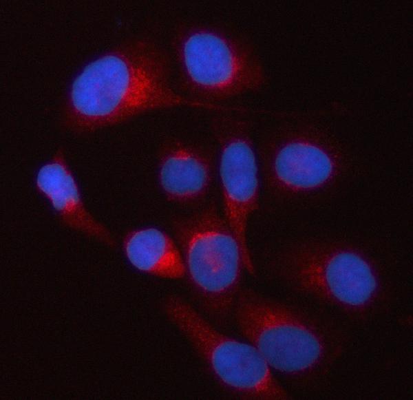  IF analysis of TWF2 using anti-TWF2 antibody (A09748-1)