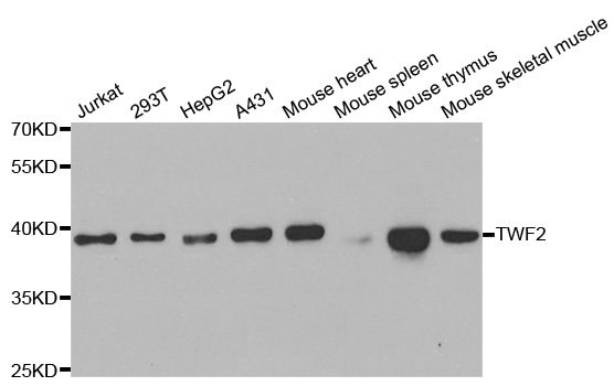 a09748 twf2 primary antiboties wb testing 1
